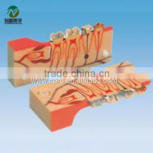 BIX-L1003 Tooth Decomposition Model of the Organization thumbnail-1