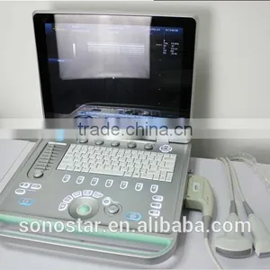 3D,4D Portable Doppler Color Ultrasound Machine for Women With Baby thumbnail-1