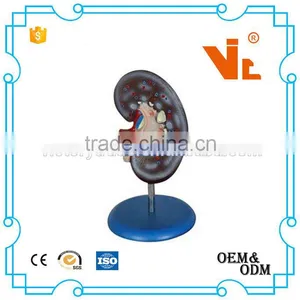 V-AM061 Best Price Medical Plastic Kidney Model thumbnail-1
