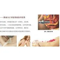 15W Mini Diode Laser Vaginal Tightening Surgery. thumbnail-1