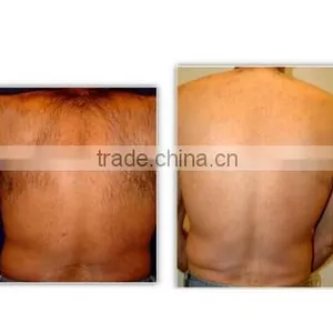 HOT In World Portable Ipl Hair Removal/hair /permanent Hair Removal/ With CE+manufactory for Clinic , Family Adn Beauty Spa thumbnail-6