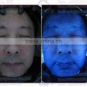 90% Accuracy Woods Lamp for Skin Analysis With UV Voice System thumbnail-2