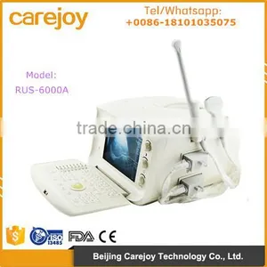 CE Approved Low Price 10 Inch Digital Ultrasound Machine With Convex Probe for Hospital Clinic Community RUS-6000A thumbnail-1