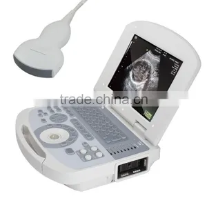 Electric Ultrasonic Equipment High-frequency Beam-former Cheap Ultrasound Machine Price thumbnail-3
