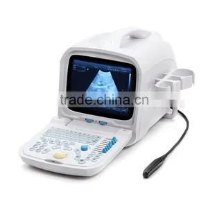 Beautiful Compact Diagnostic Ultrasound Probe / Mini Ultrasound Machine / Portable Ultrasound Scanner thumbnail-2