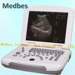 Version Full-Digital Laptop Ultrasound Scanner thumbnail-1