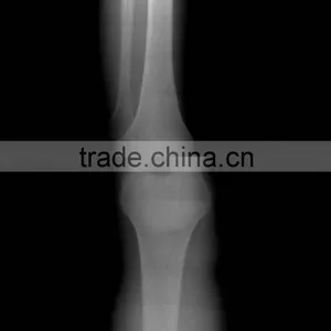 Ccd Flat Panel X-ray Detector 14x17 thumbnail-4