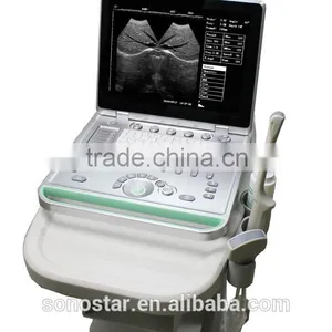 SS-7 Laptop Ultrasound Scanner thumbnail-6