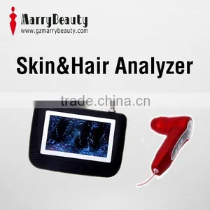 New Product Low Price Portable Skin and Hair Analyzer Quality Choice thumbnail-1