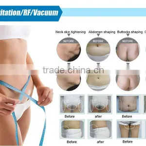 CE Approved 5 in 1 Weight Loss Mono Polar Ultrasound Slimming Skin Tightening thumbnail-6