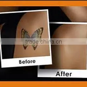 Q Switch Nd Yag Laser Powerful 2000mj Brown Age Spots Removal Laser Tattoo Removal Machine / Tattoo Removal Machine 800mj thumbnail-6