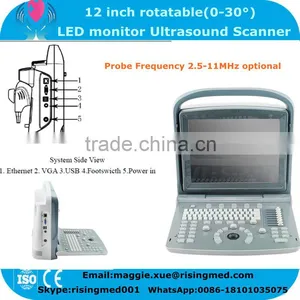CE / ISO Certified Ultra Light Ultrasound Scanner With 2.5-5.0MHz Convex Probe High End Medical Equipment thumbnail-1