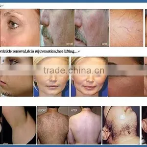 Weifang KM KM-E-600C+ 9 in 1 Multifunction Beauty Machine for Slimming thumbnail-6