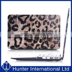 Superior Fancy For Macbook 11" Leather PC Cover thumbnail-1
