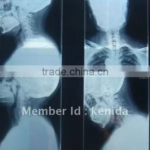 Imaging Medical Ray Film,digital X-ray Cr,agfa Thermal Film Sale From Factory thumbnail-1