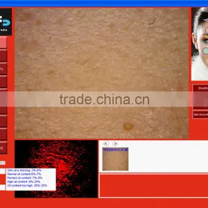 Professional Clinic Use Face Skin Analysis Equipment With FCC/CE Approval thumbnail-2