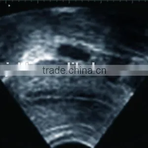 Notebook Ultrasound Scanner RUS-9000F With 3.5Mhz Convex Probe and 7.5Mhz Linear Probe Diagnosis Machine thumbnail-4