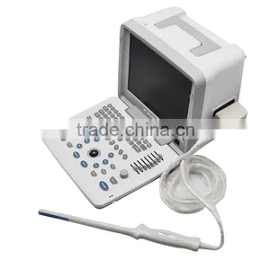 Carejoy Ultrasound Machine Portable Ultrasound Scanner With Multi Frequency Probe for Hospital Clinics Community With CE ISO thumbnail-5