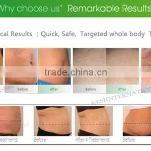 201 5Latest 5 in 1 Vacuum Cavitation RF Body Slimming Machine With Japan Motor thumbnail-4