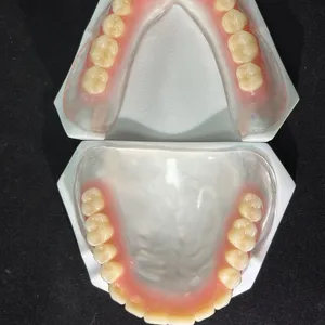 Dental Lab Custom Alloy Framework for German Dental Clinic thumbnail-4