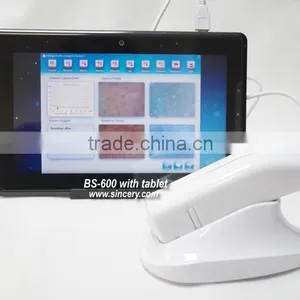 2014 New Designed Handheld Skin Analyze Camera thumbnail-6