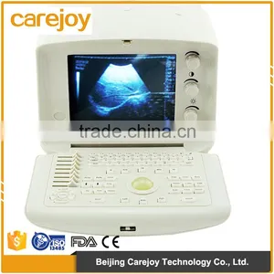 CE ISO Approved One-stop Shopping Service pc Based Ultrasound Scanner Portable Laptop thumbnail-1