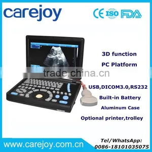 Big Sale PC Platform 10.4 Inch Laptop Ultrasound Scanner With 3.5Mhz Convex Probe CE ISO Certified thumbnail-1