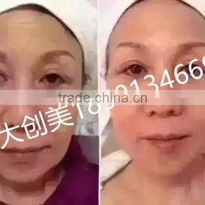New Products 2016 Technology Portable Face Lift Health and Beauty thumbnail-6