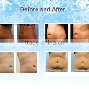 Fat Reduction TaiBo Beauty SUPER Promotion !!!Good Effect Cryolipolysis Lose Weight Machine/laser Lose Weight(809nm Laser Led) 500W thumbnail-6