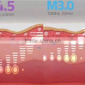 0.1-2J Portable Safety Color Touch Screen Vaginal Rejuvenation HIFU / HIFU Machine High Intensity Focused Ultrasound thumbnail-3