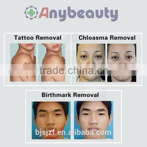 2016 High Quality nd Yag Laser Tattoo Removal Laser Picosure for Tattoo Removal thumbnail-5