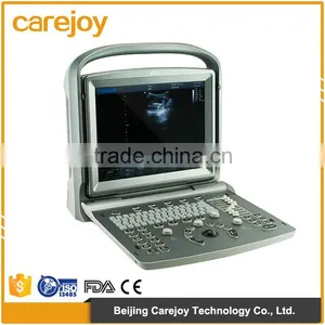 China Cheap Price USB Portable Laptop Color Doppler Ultrasound Scanner for Pregnancy Scanner Ultrasound thumbnail-1
