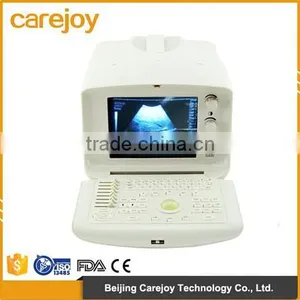 Cheap Price Digital Portable Ultrasound Machine/Scanner With Convex/linear/transvaginal Probe thumbnail-1