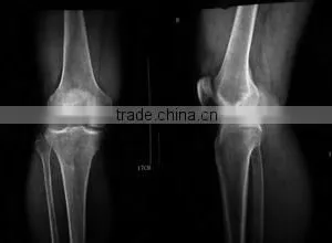 Medical X-ray Film Agfa Medical Dry Film for X-ray Machine Agfa Kodak Film thumbnail-5
