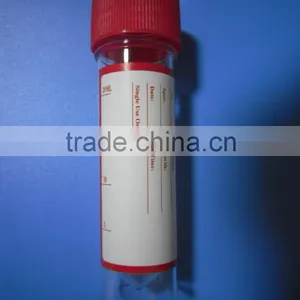 Plastic Urine Specimen Collection Cup,Urine Cup thumbnail-3