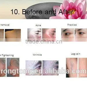 2016 Hot Selling Professional RF Beauty Machine Korean Beauty Equipment thumbnail-5
