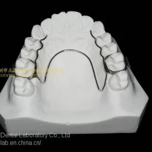 Space Expanders, Nance Appliance, Helix Appliance, Pendulum Appliance, ﻿﻿﻿﻿Porter Appliance, Fixed Lingual Expander, Sagittal Screw Appliance, Hyrax Rapid Palatal Expander, Orthodontic Retainers, Dental Orthodontic Appliance, Laboratoire Dentaire, Dentall thumbnail-4