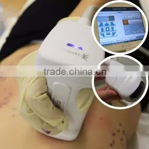 Nasolabial Folds Removal Liposonix High Intensity Focused High Frequency Acne Machine Ultrasound HIFU Body Slimming Machine Face Lifting thumbnail-4