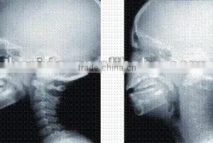 Imaging Medical Ray Film,digital X-ray Cr,fuji Thermal Film Sale From Factory in Hangzhou thumbnail-1