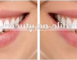 AYJ-J003A Laser Teeth Whitening Machine /teeth Whitening Laser thumbnail-6