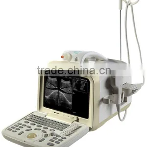 Ultrasound Scanner Used for Pregnancy thumbnail-1