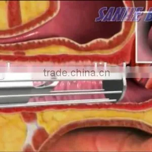 Best Treatment Result for Laser Vaginal Tightening Treatment 40W Fractional Co2 Laser thumbnail-5