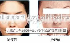 Skin Lifting High Quality Hot Selling Pdt Led Infrared Therapy Systems Led Lamp For Sewing Machine Anti-aging thumbnail-6
