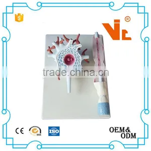 V-AM039 Medical Plastic Teaching Anatomical Neuron Model thumbnail-1