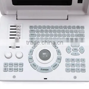 CE Approved Laptop/Portable Ultrasound Scanner With 3.5Mhz Multi-frequency Convex Probe RUS-6000D thumbnail-3