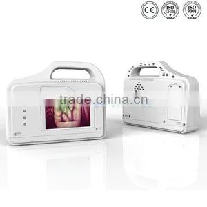 YSVV200 Guanghzou Hot Vein Illumination Device Price thumbnail-1