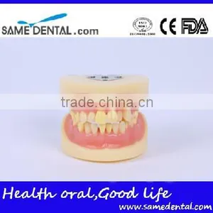 Dental Extraction Model School Teaching Model Teeth Model thumbnail-1