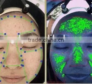 Skin Analyzer Machine Allergy Testing Analyser Machine thumbnail-5