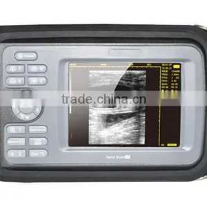 HandScan H8 Portable/palm Handheld Ultrasonic/ Ultrasound Machine Lower Price/medical Equipment thumbnail-2