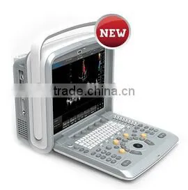 CE Approved Portable Color Ultrasound Scanner With Optional 4D Function( Q9) thumbnail-1